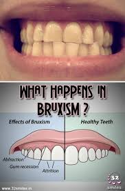 Pin On Dental Posters