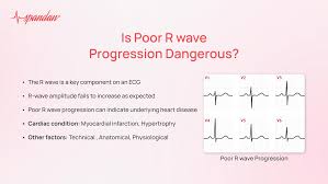 Image result for R Wave