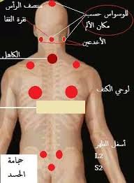 علاج بالحجامه للعقم والمس الحجامة النبوية في صفاقس facebook