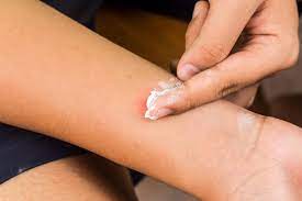 Les piqûres de punaises des lits ont tendance à survenir le long d'une ligne droite, dans une configuration connue comme le petit déjeuner, le déjeuner et le dîner. Piqures De Punaises De Lit Comment Les Traiter