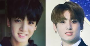 Is Bts Addicted To Plastic Surgery We Asked A Plastic Surgeon In Beverly Hills Plastic Surgery Plastic Surgeon Bts Plastic Surgery