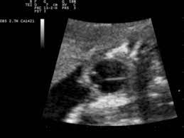 You can excel at answering when someone asks you to tell them something about yourself if you use these 6 simple pieces of dating advice: Question Can Ultrasound Tell When You Conceived From Conception To Birth