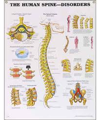 The Human Spine Disorders Anatomical Chart