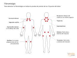 Hola los invito a que vean nuestro nuevo vídeo fibromialgia puntos dolorosos, dolor crónico y enfoque natural (dr javier e moreno) el cual estará disponible a partir de mañana en nuestro canal. Que Es La Fibromialgia Y Como Tratar Sus Dolorosos Sintomas