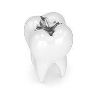 Check spelling or type a new query. Get Filled In Which Type Of Dental Filling Is Right For You
