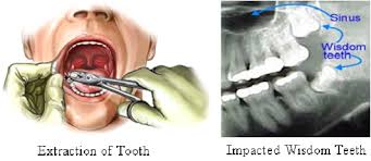 See more of oral and maxillofacial surgery department, al azhar university on facebook. Oral Maxillofacial Surgery Wejdan Smc