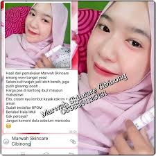 Kalau udah mulus bening...