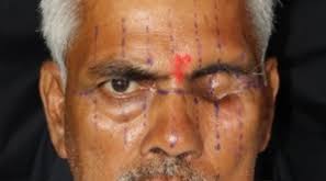 Marking of reference lines