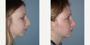 Top Facial Reconstructive Surgery Doctors in Langhorne, PA