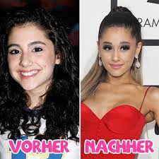 Die polizei spricht nach den explosionen bei einem konzert in manchester. So Sah Ariana Grande Vor Ihren Beauty Ops Aus Starzip