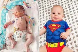 The most common testicular cancer symptom is a lump or a swelling in your testicle. Newborn Baby Born With Congenital Fibrosarcoma Cancer That S Life Magazine