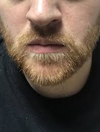 It is true that beards have been in high demand these days. 3 Weeks In Am I Looking At A Red Beard It Keeps Going From Brown Blonde To Red Blonde My Normal Hair Is Dark Blonde Red Beard Red To Blonde Brown To