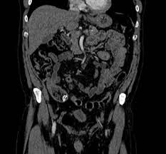 We did not find results for: Centrul De Imagistica Pozimed Reginamaria Ro