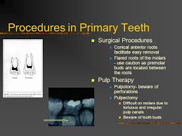 • the panel recommends the use of tricalcium silicate in vital primary teeth with deep caries lesions treated with pulpotomy due to pulp exposure. Anatomy Of Primary Teeth Ppt Video Online Download