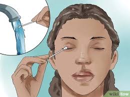 Styes are irritating and painful and every person suffering from one of these red bumps on the eyelid quickly searches for a treatment to take it away it is important that any treatment you try is safe, as styes are so close to the eye. How To Get Rid Of A Stye 11 Steps With Pictures Wikihow