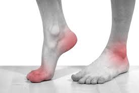Image result for Foot Pain