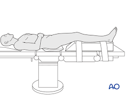 We did not find results for: Supine Position