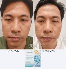 Credit by Koh Seng Kian ✨【8 天AmCELL 见证】✨ 不只眼睛看到，自己也能感觉到的改变☺️  AmCELL，从内到外的呵护✨ 👉 白发变少👉 头发变得更浓密有光泽