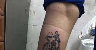 Arkadaslar Dovme Yaptirdim 2 Gun Oldu Kizlarsoruyor