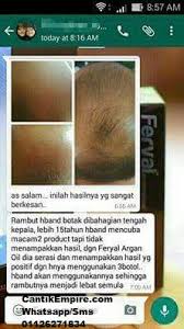 Argan oil helps to prevent cancer, moisturize the skin, speed wound healing, lower cholesterol levels the most important health benefits of argan oil include its ability to speed up wound healing. Feryal Argan Oil Review Testimoni Feryal Argan Oil Harga Feryal Oil
