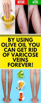 Pin On Health Buzz