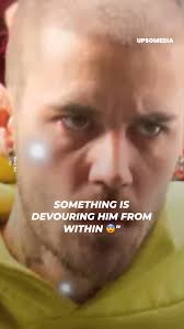 How thin he is and his sad expression betrayed nothing good 😔 📹:  https://www.instagram.com/backgrid_usa/