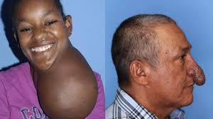 La nariz deforme y los otros antes y después más impactantes de las  cirugías del verdadero doctor Milagro: construyó una oreja de cero y  extirpó deformidades