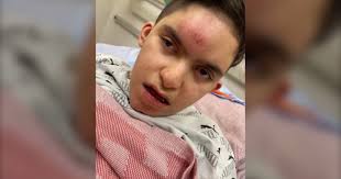 Edmonton boy, 10, has head injuries, broken arms after 'incident'