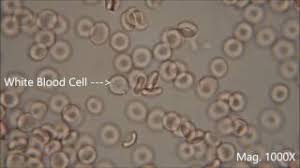 Cytolysis - An Overview | Sciencedirect Topics