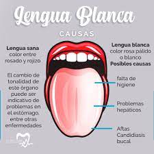 Clinic Sax La Lengua Blanca Se Produce Como Resultado Facebook