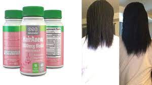 Although there isn't good scientific evidence that taking biotin supplements will help thinning hair to grow or nails to get stronger, people who take biotin supplements will often see a benefit,. How To Regrow Thinning Hair By Biotin Hair Growth Vitamins Youtube