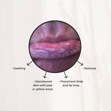 Image result for Oncinotis