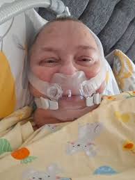 Good morning, can anyone help me, a week or so ago I started to get mouth  ulcers and what looked like a fungal infection in my mouth and swollen lips  , I