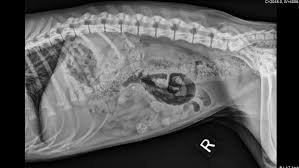 Image result for Abdominal XRay