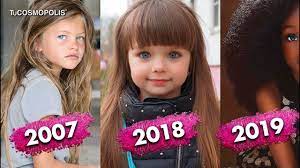Ella Es La Nina Mas Bonita Del Mundo Del 2019 La Cual Ha Roto Los Estandares De Belleza Youtube