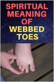 The treatment to correct webbed toes usually involves surgery to remove the extra skin. Syndactyly Webbed Toes Spiritual Meaning Causes Spiritual Meaning Spirituality Emotional Meaning