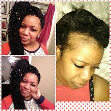 Due to Lupus i was told my hair wouldn't grow no more. I lost my hair back  in 2006 n now using wild grow its a miracle.. The red pics are from