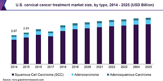 This type of cervical cancer begins in the thin, flat cells (squamous cells) lining the outer part of the cervix, which projects into the vagina. Cervical Cancer Treatment Market Size Share Industry Report 2025