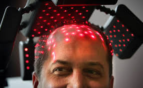 Laser therapy for hair growth can be used to stop hair loss in men and women. Laser Hair Therapy Sareen Hair Clinic