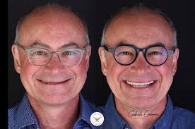 One of my patients arrived at my dental practice with concerns that went  beyond the cosmetic or esthetic. The issues she was facing included  elements that went beyond restoring her smile. She