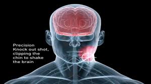 The trick is compressing the plexus of nerves that run through the neck as well as the carotid artery, stopping the flow of blood to the brain. Four Ways To Knock Someone Out In A Street Fight