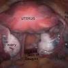 Located, reproductive, female anatomy, female pelvic anatomy netter, female pelvic anatomy pictures, female pelvic area diagram, female pelvic. 1
