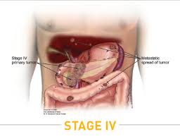 Image result for pancreas location