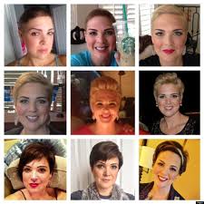 Woman S Hair Transformation After Chemo Is Beautiful Hair Growth After Chemo Hair Implants Hair Transformation