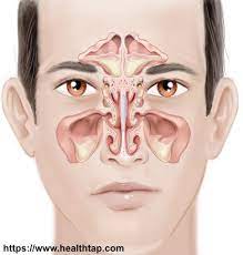 More Marcons Biotoxin Journey