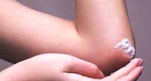 Jul 01, 2021 · exfoliants: Dry Elbows Remedies Causes And More