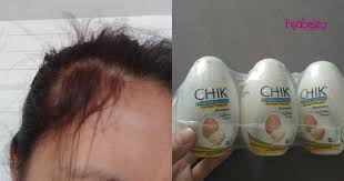 Petua tips rambut gugur lebatkan rambut|cara atasi masalah keguguran produk murah rahsia tips cara melebatkan rambut gugur dalam masa 3 hari secara percuma. Wanita Ini Pakai Syampu Beli Di Kedai Eco Tiada Lagi Masalah Rambut Gugur Hijabista Malay News Malaysian Newspapers From Kuala Lumpur