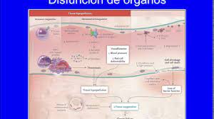 (figura 2)5 fisiopatologia del shock septico exotoxinas: Fisiopatologia De La Sepsis Youtube