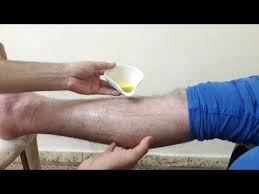 Pin On طب و صحة