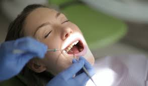 The process is called root scraping. Tartar On Teeth How To Remove It Without A Dentist